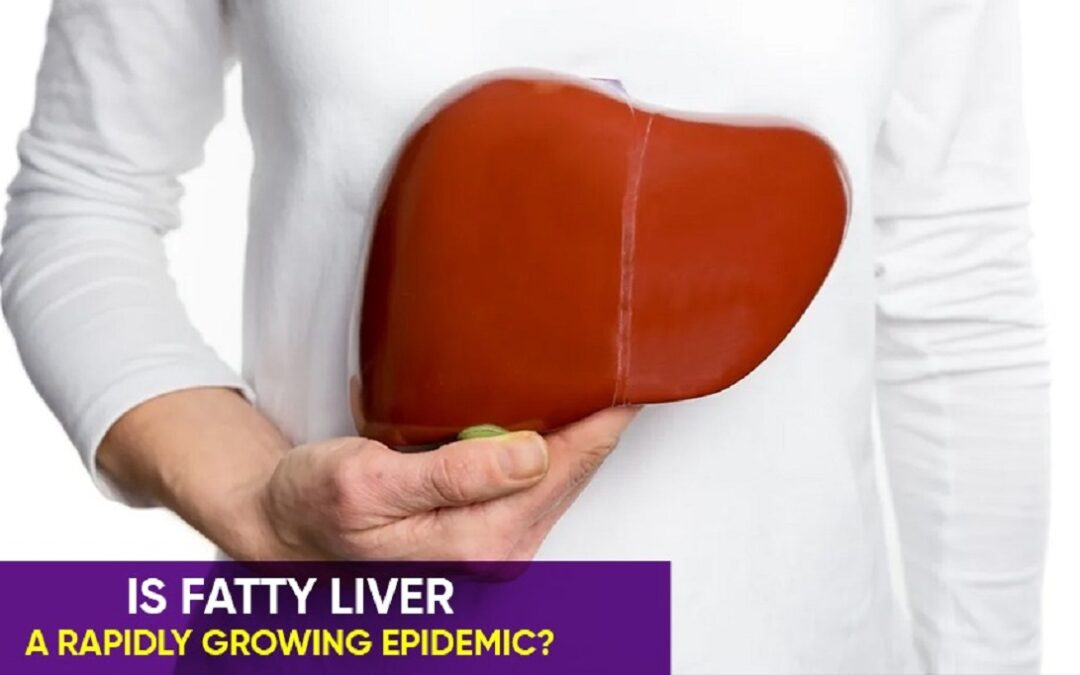 Is fatty liver a rapidly growing epidemic?