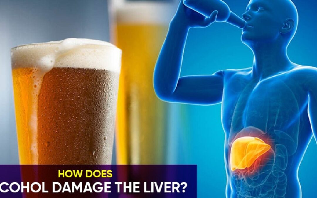 How Does Alcohol Damage The Liver?