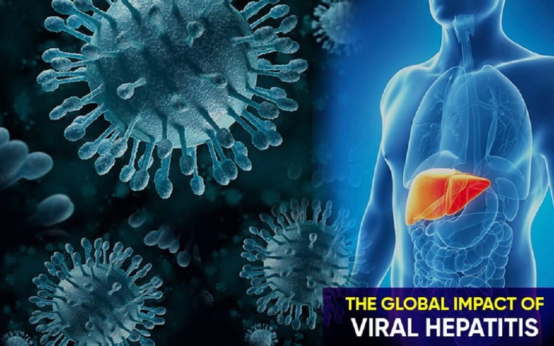 The Global Impact of Viral Hepatitis