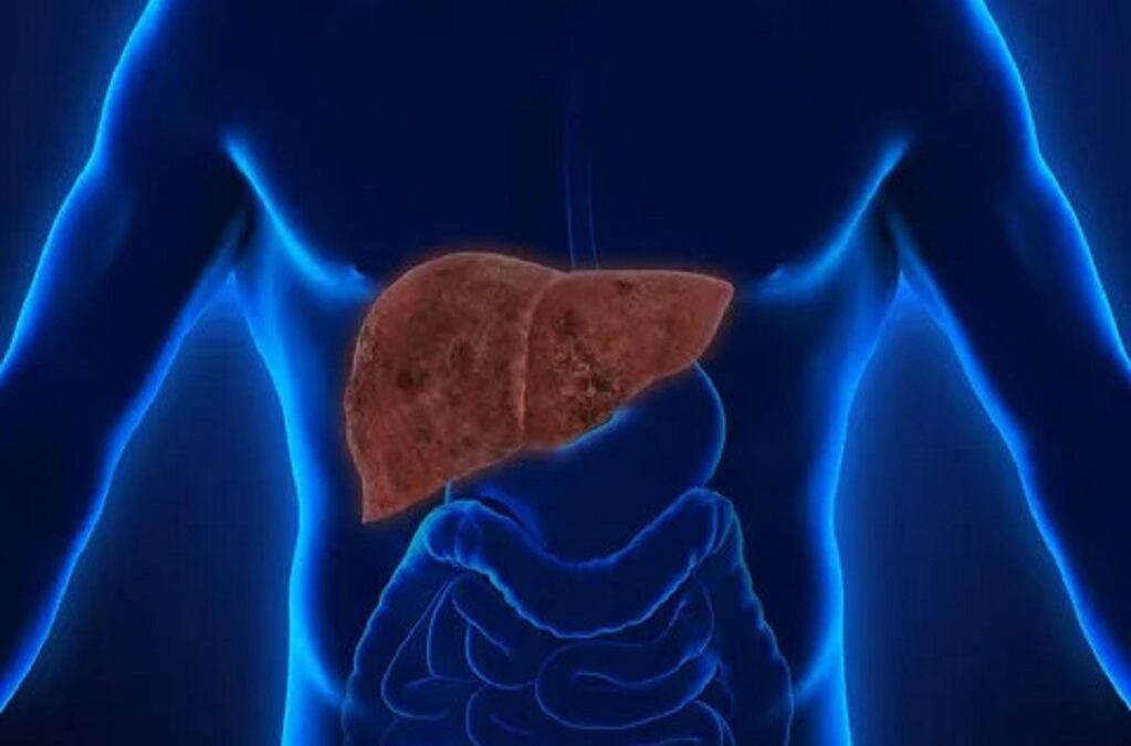 Types of Liver Disease and The Role of Diet in Managing Liver Disease